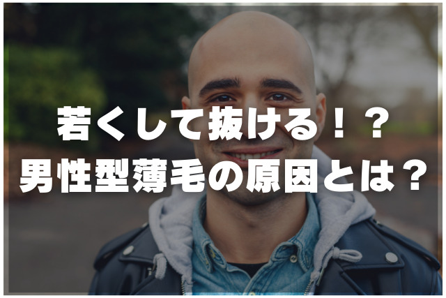 若くして抜ける、男性型薄毛の原因とは？