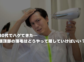 30代でハゲてきた…頭頂部の薄毛はどうやって隠していけばいい？