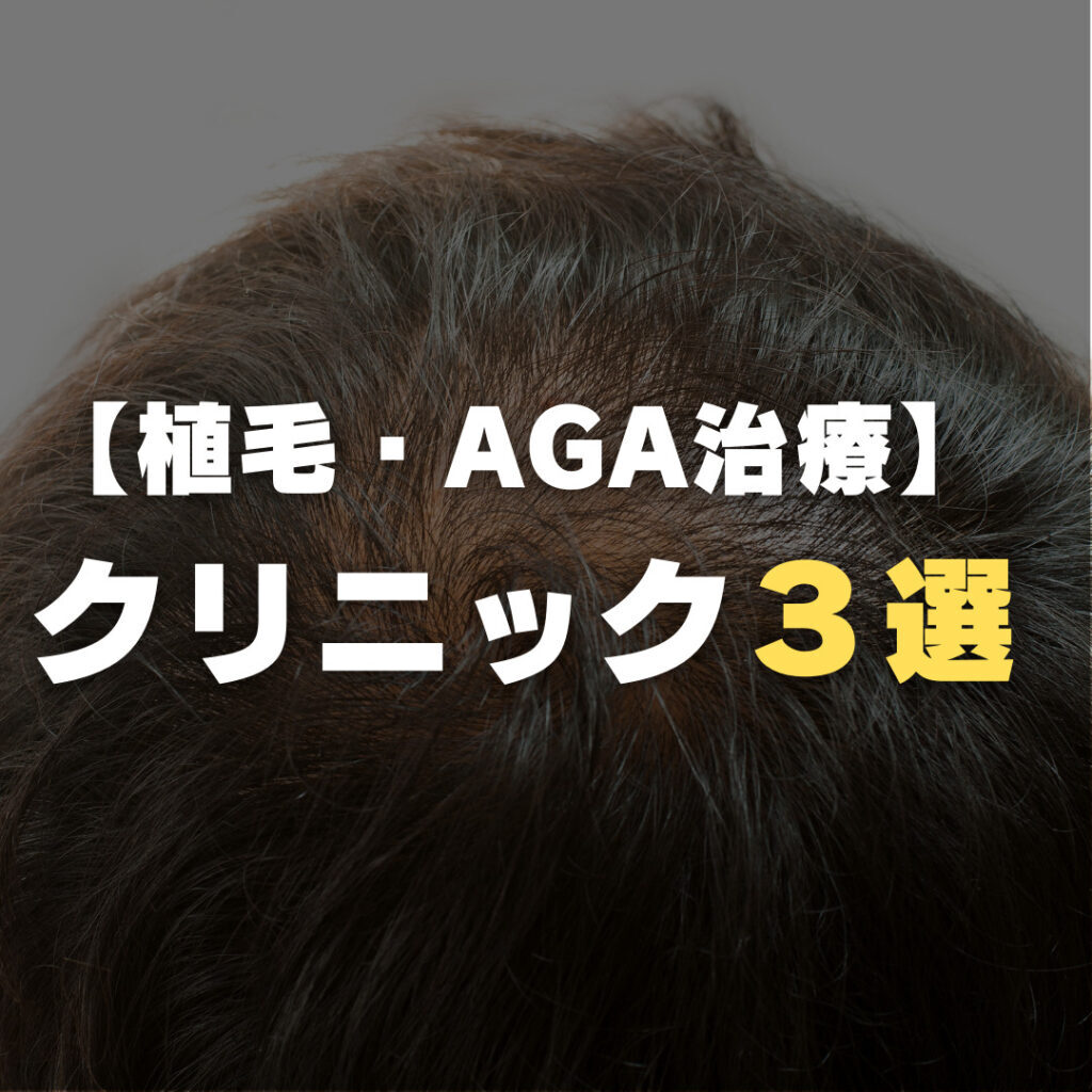 【植毛・AGA治療】問い合わせが殺到しているクリニック３選