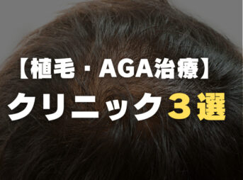 【植毛・AGA治療】問い合わせが殺到しているクリニック３選